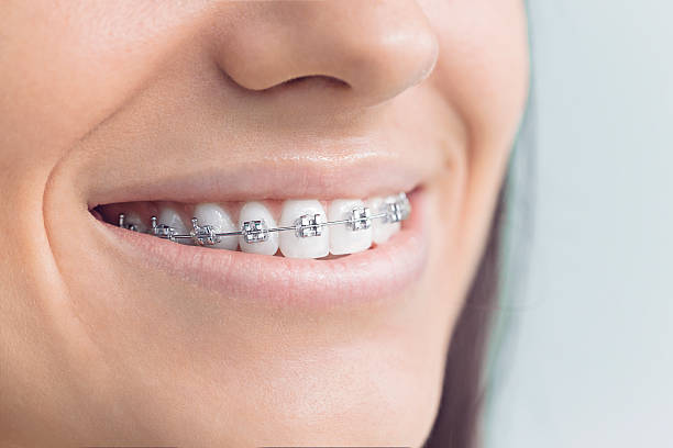 Why Choose Us for Your Dental Needs in Winter Garden, FL